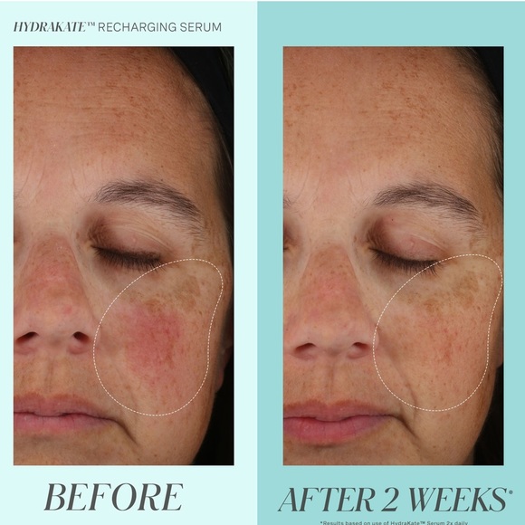 💦 Kate Somerville HydraKate Recharging Serum - Picture 3 of 11